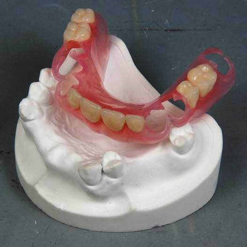 What is the advantage of removable dentures?